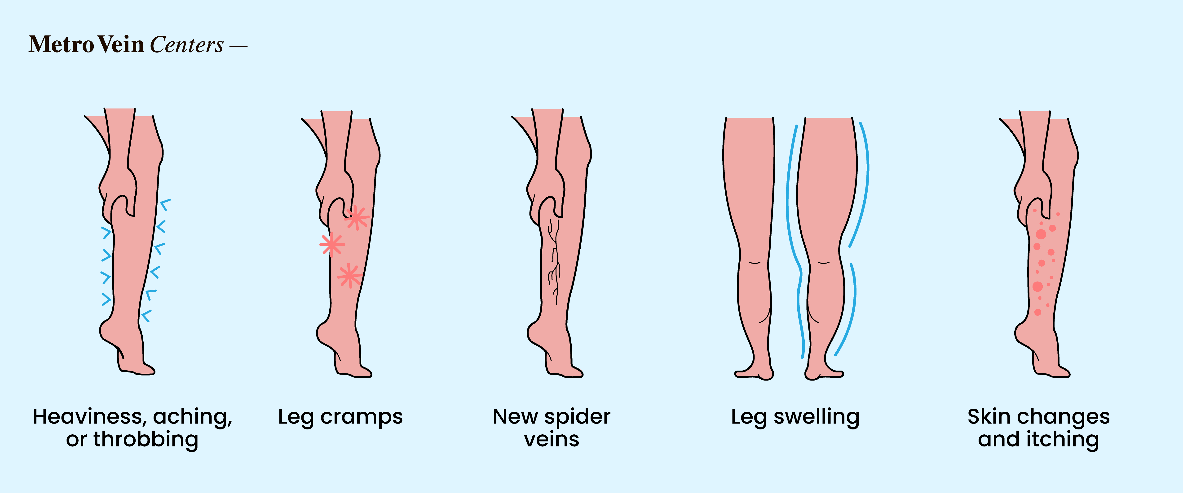Discover how chronic stress affects leg veins—from circulation changes to varicose risks—and proven ways to protect your vein health.