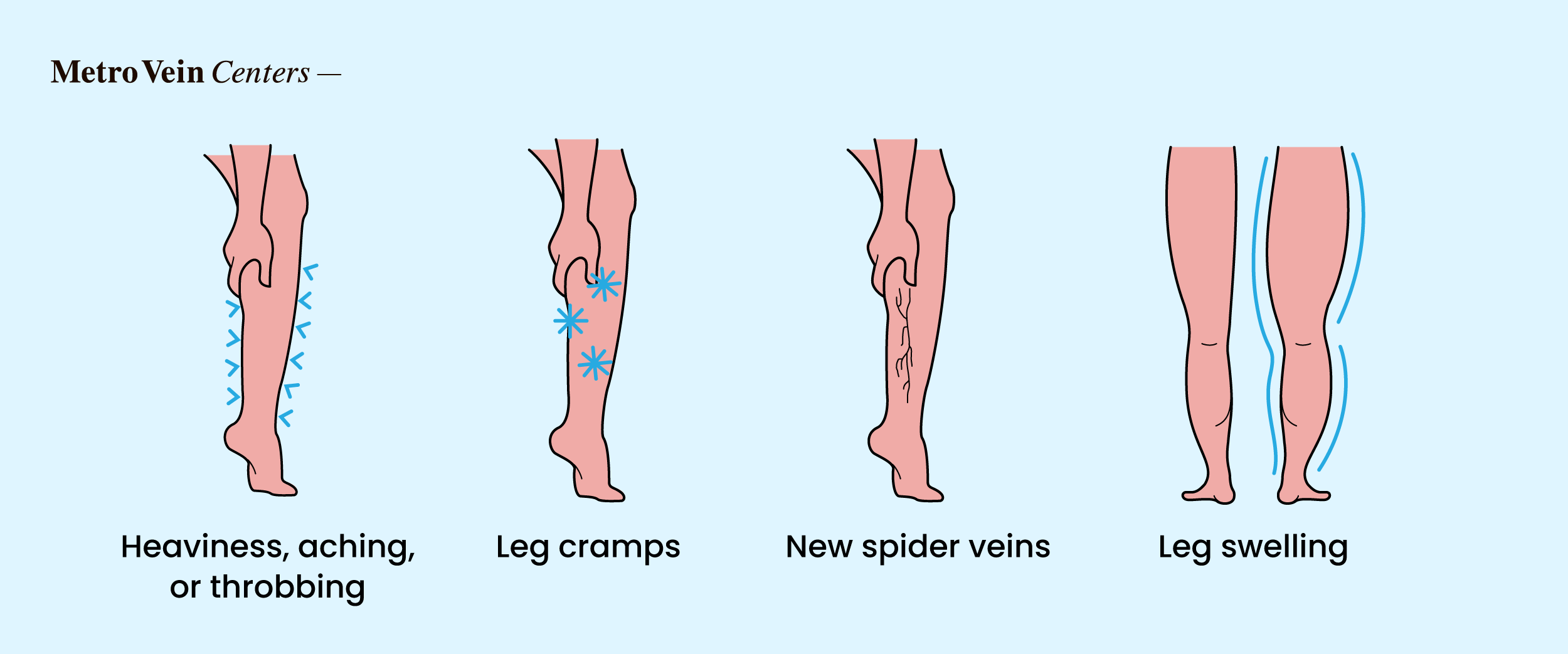 Discover how chronic stress affects leg veins—from circulation changes to varicose risks—and proven ways to protect your vein health.