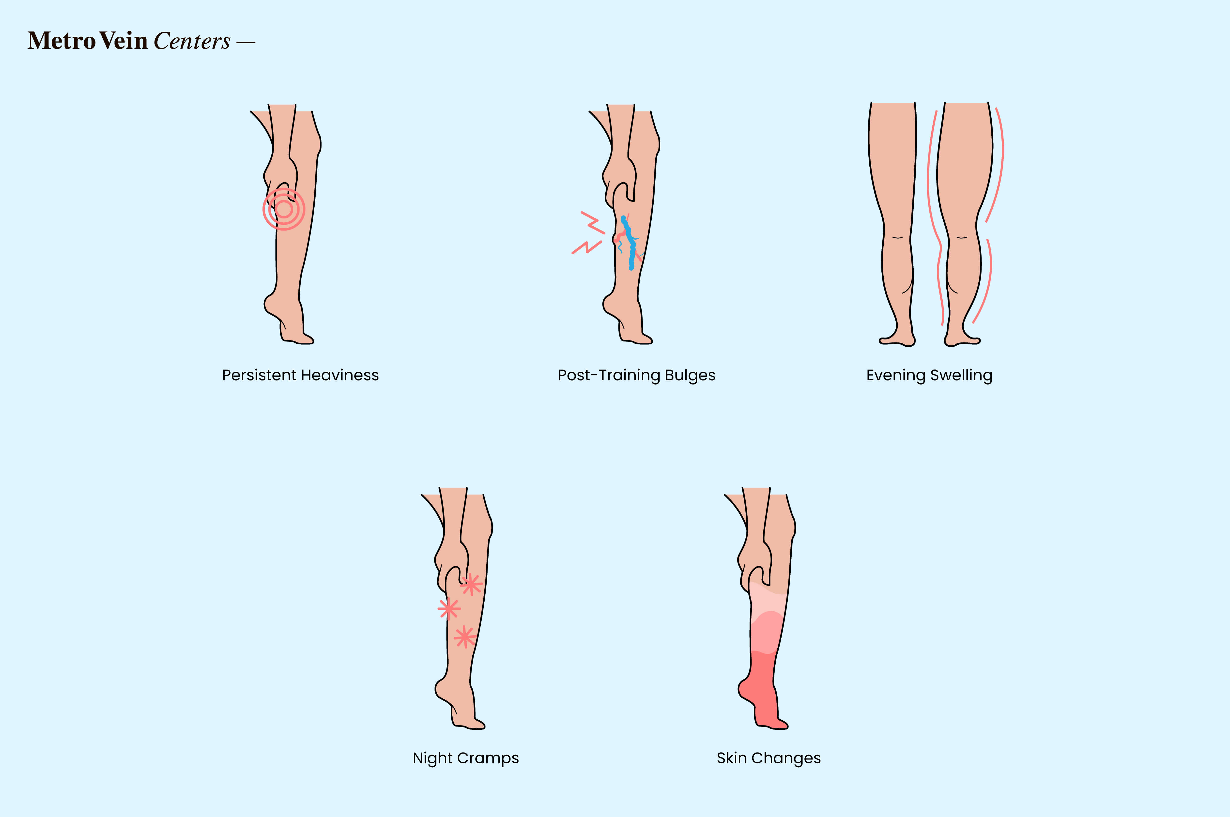 warning signs of vein strain
