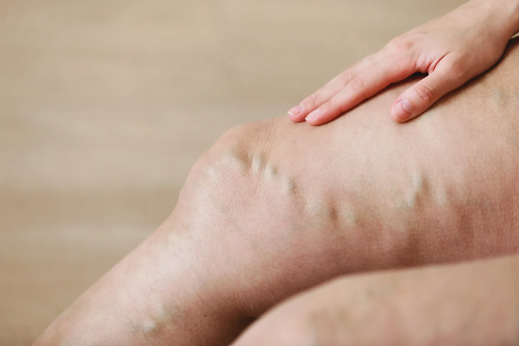 Learn the warning signs, treatments, and prevention tips for emergency vein diseases. Act fast to protect your health!