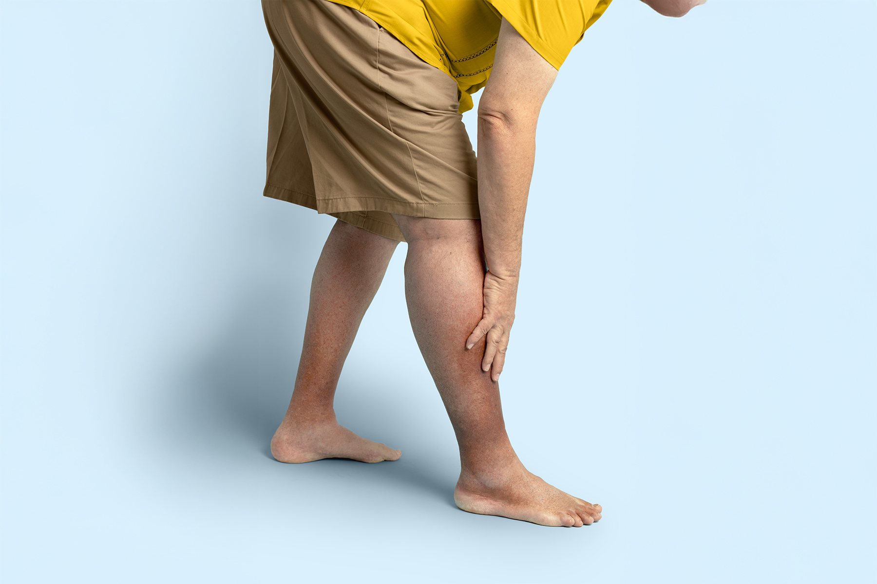 President Trump’s chronic venous insufficiency (CVI) diagnosis explained: symptoms, causes, and modern treatments for this common, treatable vein disease.