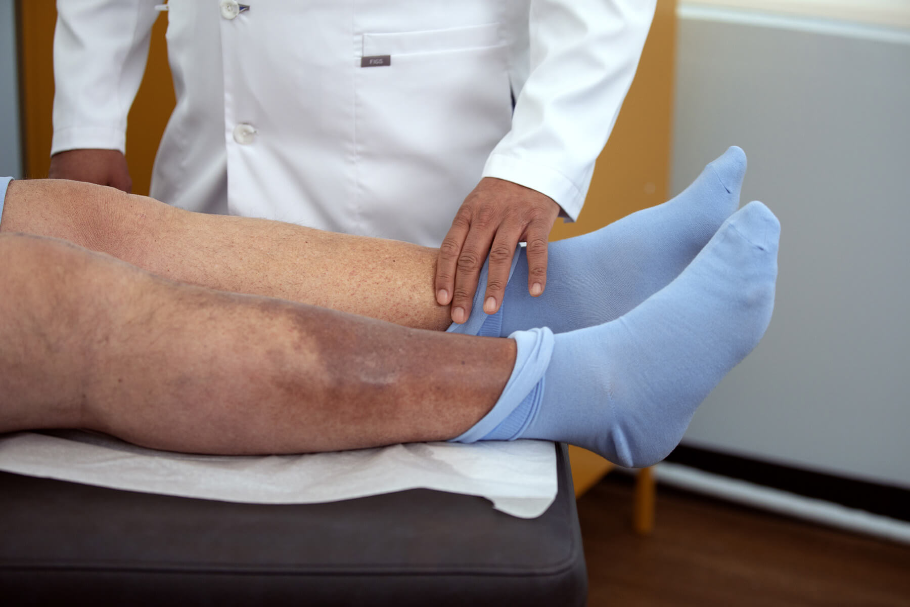 chronic venous insufficiency in legs