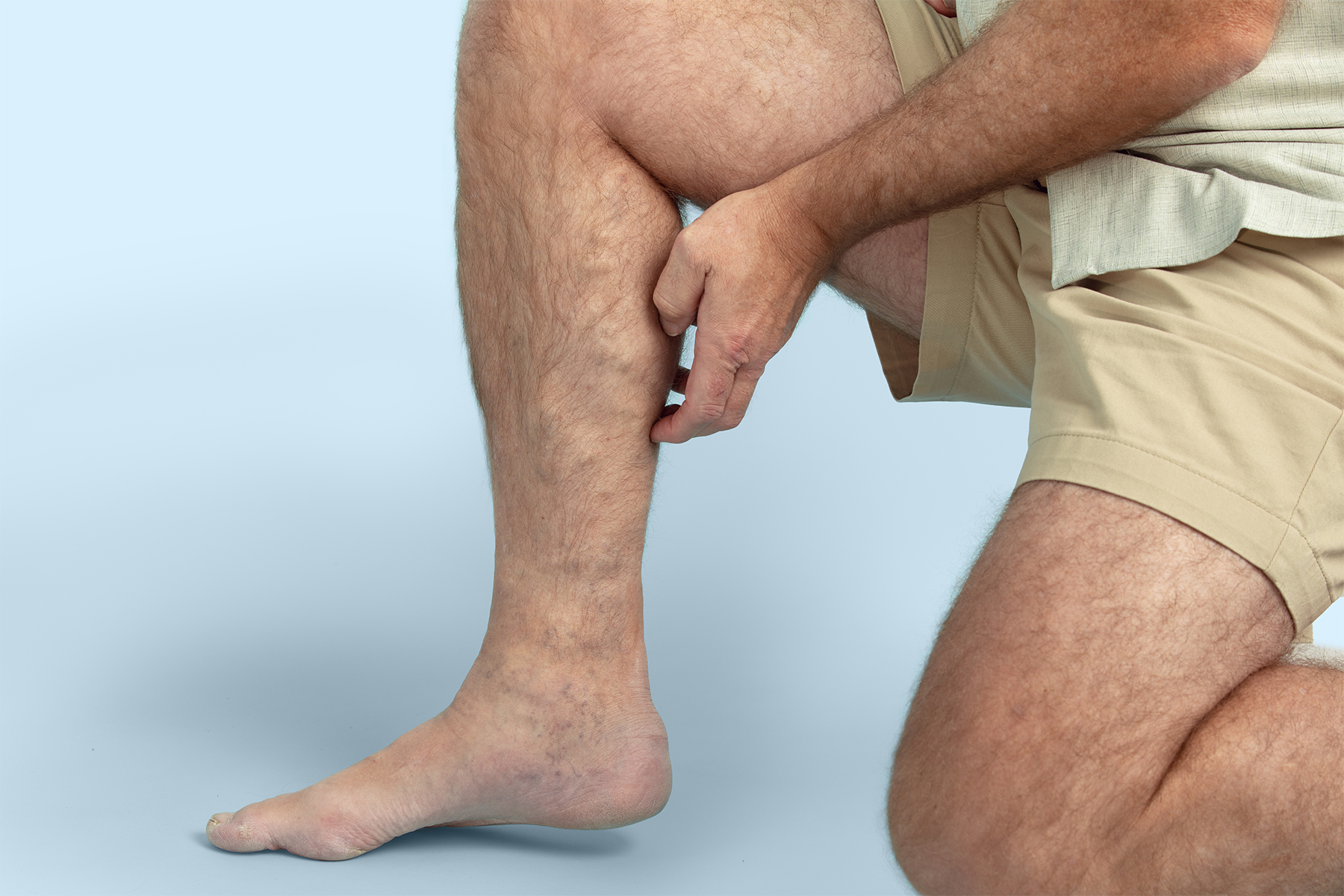 Compare top minimally invasive treatments for chronic venous insufficiency and leg swelling, including Varithena, VenaSeal, and Radiofrequency Ablation.