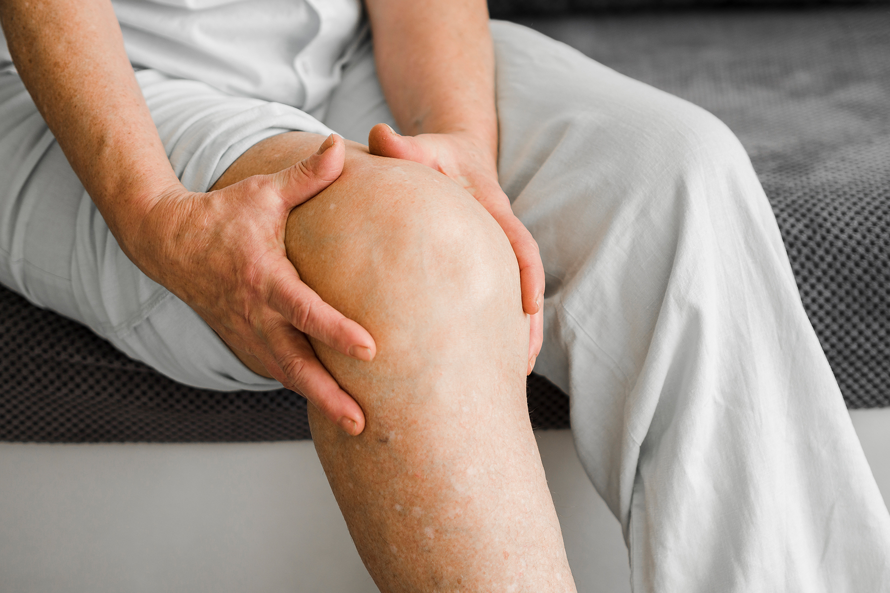 A person's leg with visible varicose veins, swollen ankles, and discolored skin, illustrating common symptoms of chronic venous insufficiency
