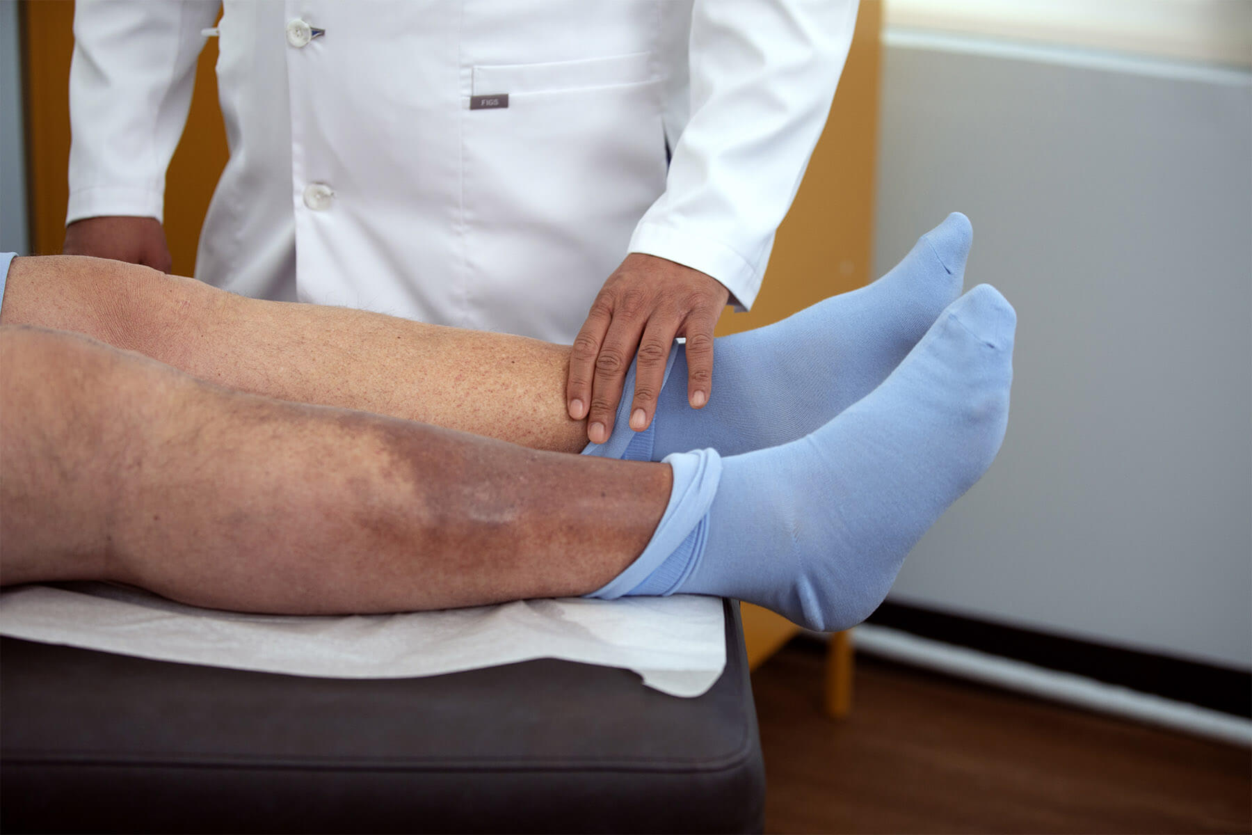 legs with heat edema