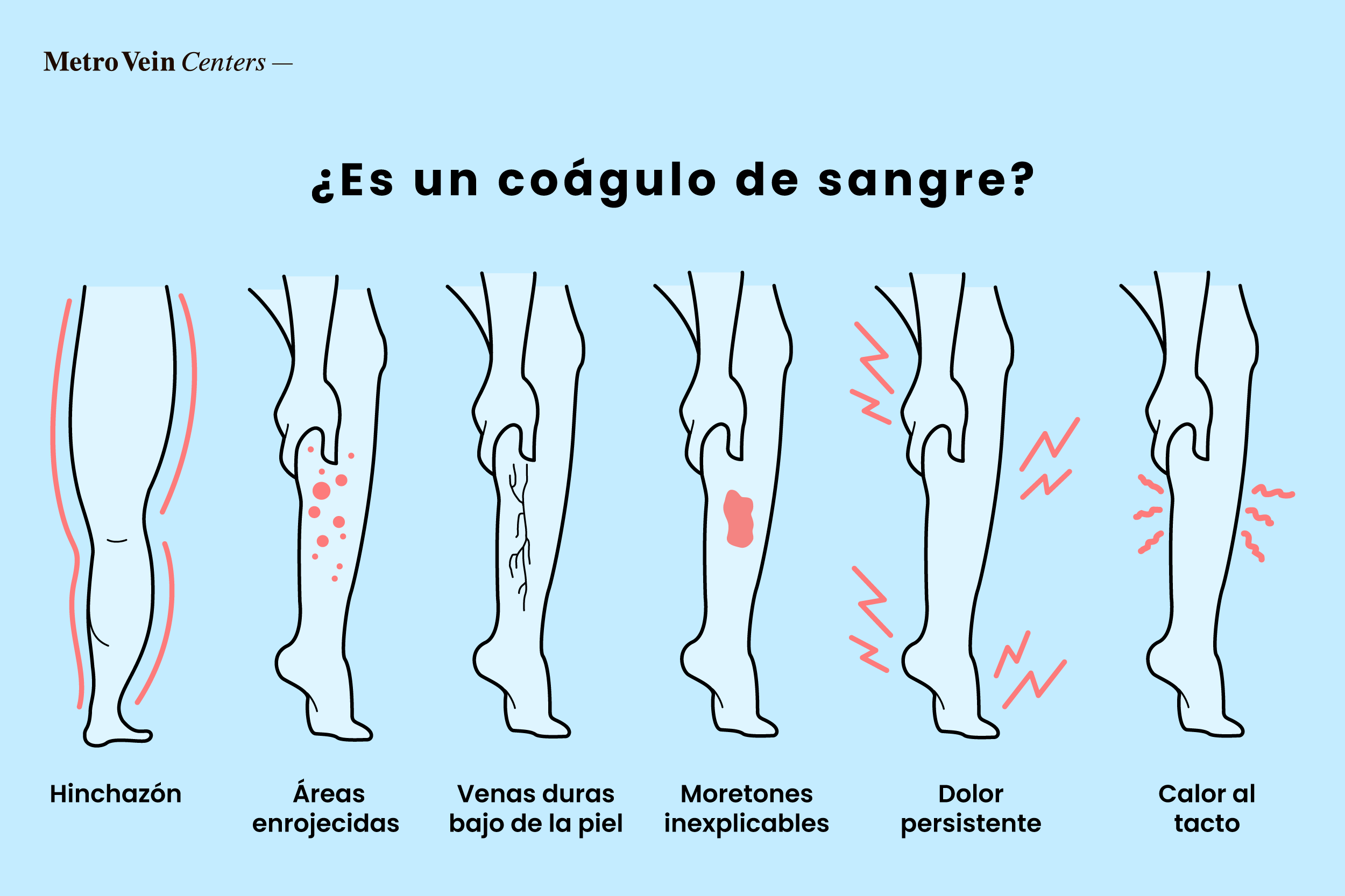Aprende a identificar coágulos de sangre en los tobillos, pies y piernas con imágenes detalladas. Descubre los síntomas, el diagnóstico y las opciones de tratamiento para unas piernas más seguras.
