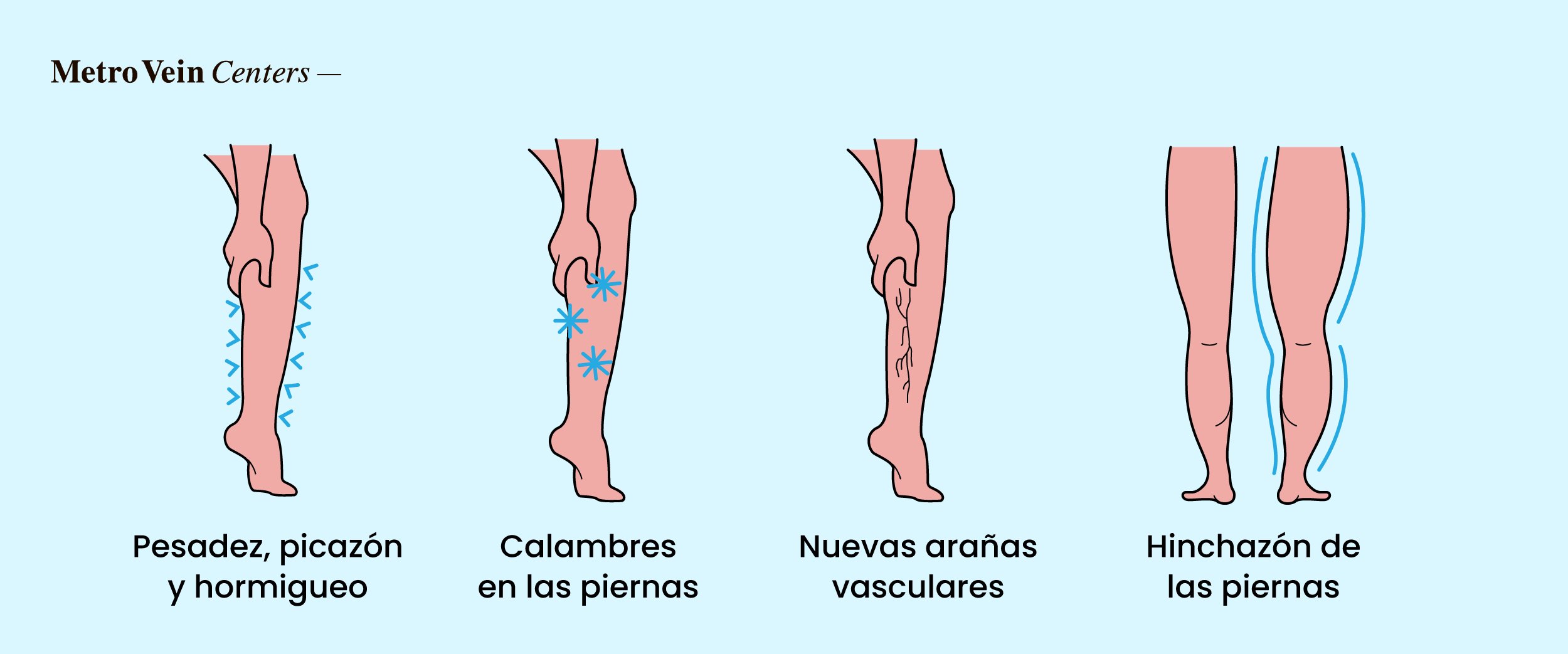 Descubre cómo el estrés crónico afecta las venas de las piernas, desde los cambios en la circulación hasta el riesgo de várices, y las formas comprobadas de proteger la salud de tus venas.