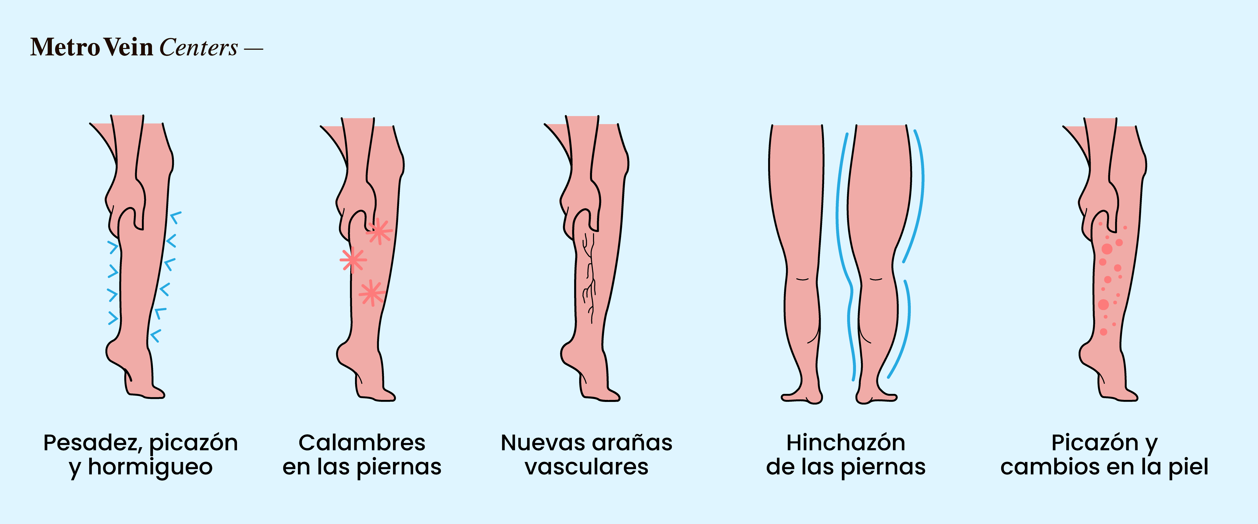 Descubre c&oacute;mo el estr&eacute;s cr&oacute;nico afecta las venas de las piernas, desde los cambios en la circulaci&oacute;n hasta el riesgo de v&aacute;rices, y las formas comprobadas de proteger la salud de tus venas.