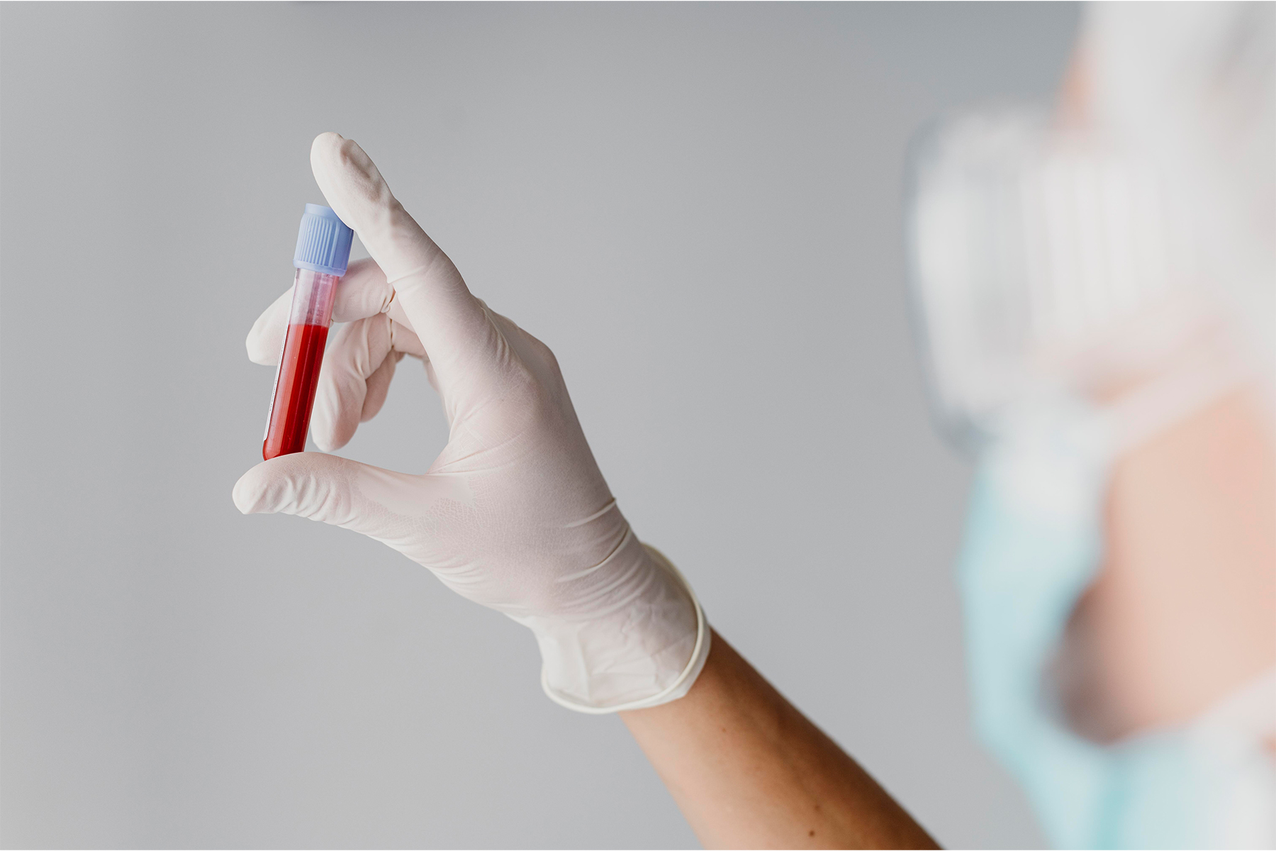 Descubra métodos integrales para diagnosticar venas varicosas, insuficiencia venosa crónica y trombosis venosa profunda. Aprenda sobre ultrasonido, pletismografía y exámenes físicos para la detección temprana.