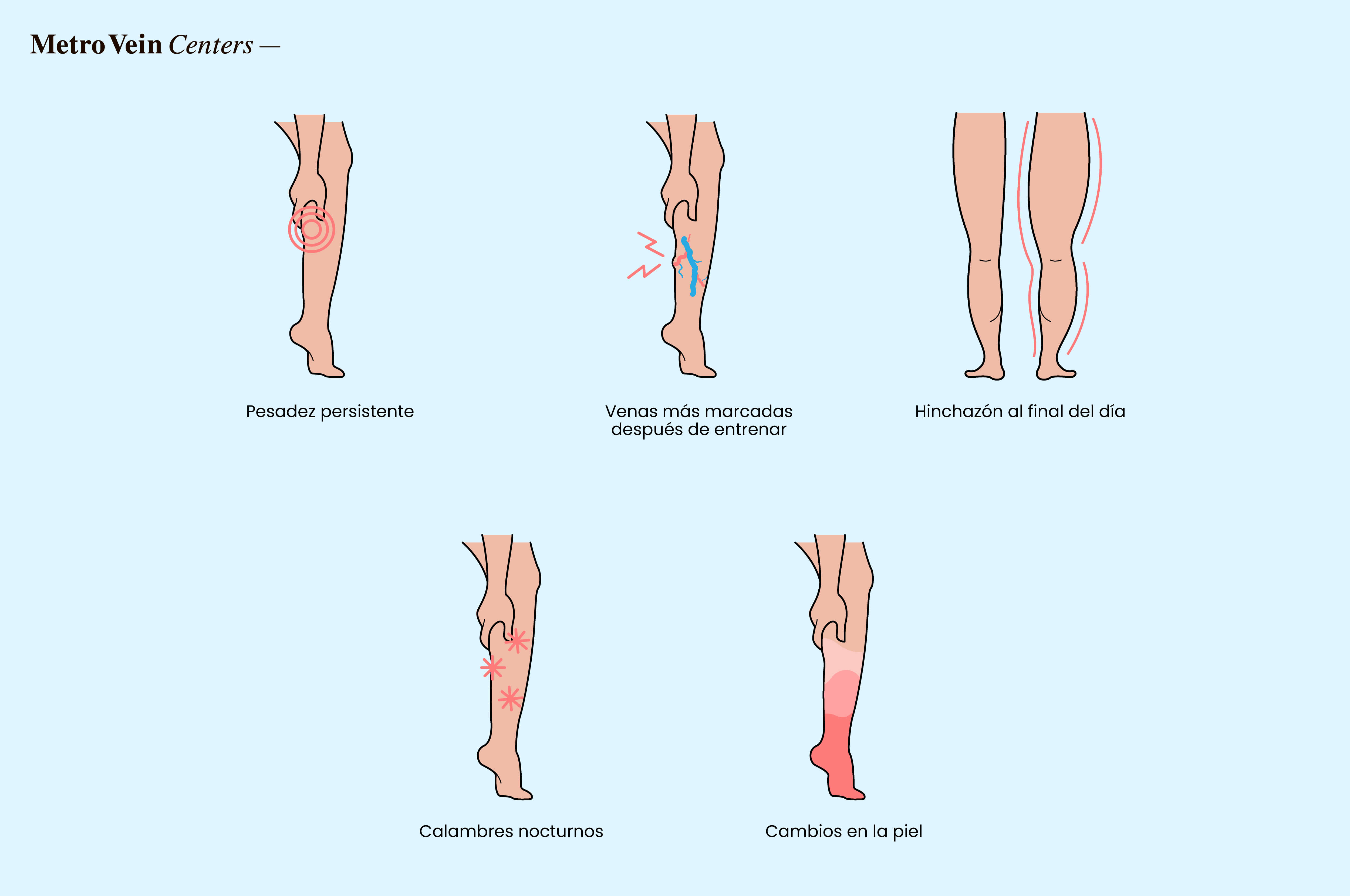 Señales de advertencia de tensión venosa