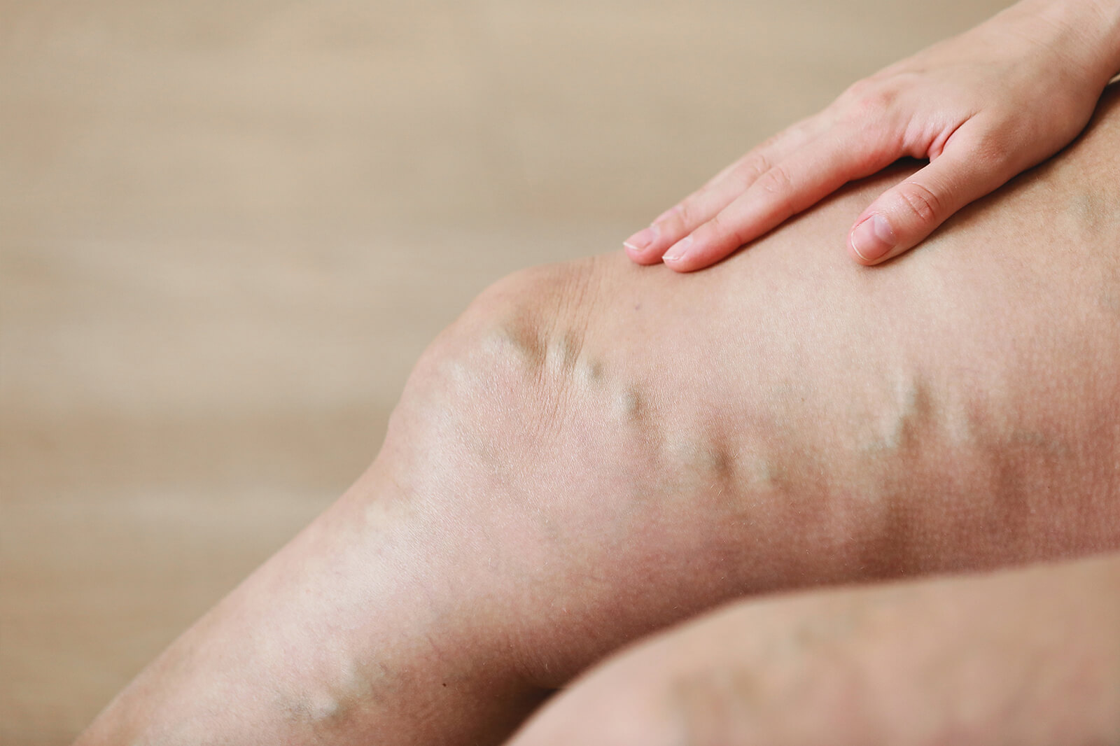 Aprende a reconocer las señales de alerta, los tratamientos y los consejos de prevención para enfermedades venosas de emergencia. ¡Actúa rápido para proteger tu salud!
