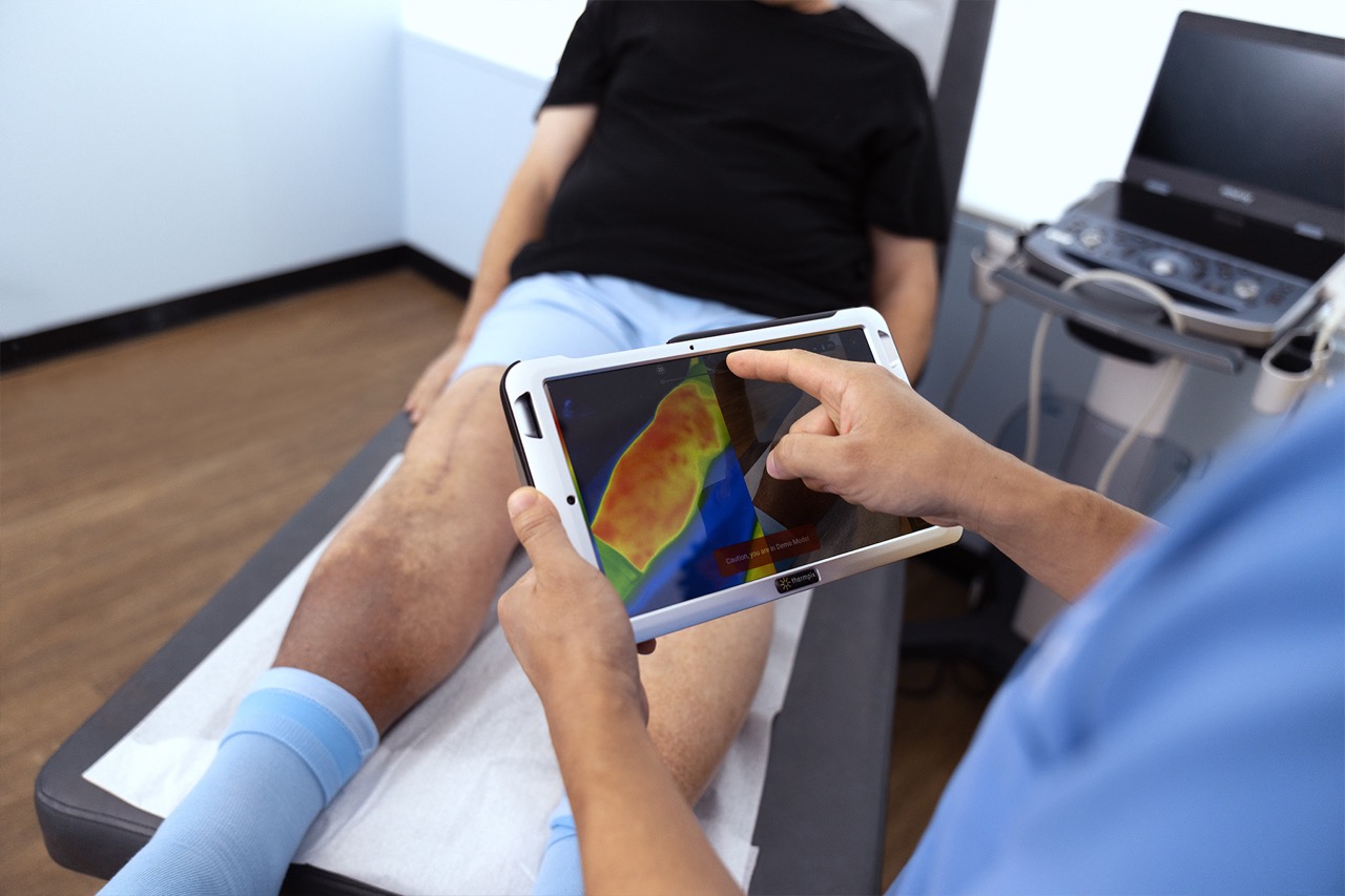 Descubre el futuro de los tratamientos venosos y los avances en la atención médica. Explora tecnologías innovadoras como HIFU, procedimientos asistidos por robots, nanotecnología y planes de tratamiento personalizados impulsados por IA. Aprende cómo los conocimientos genéticos y las técnicas mínimamente invasivas mejoradas están revolucionando el cuidado venoso para una recuperación más rápida, menos molestias y estrategias de prevención dirigidas. Mantente informado sobre las innovaciones que están transformando la salud vascular.
