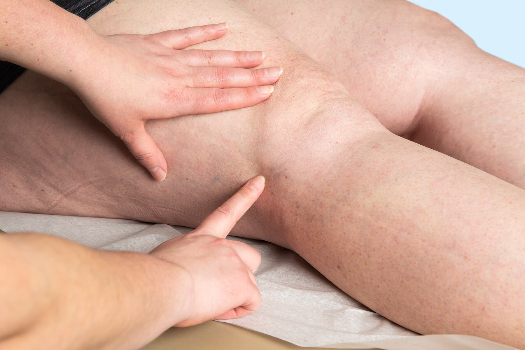 Profesional de la salud examina la parte posterior de la rodilla y la pierna de un paciente