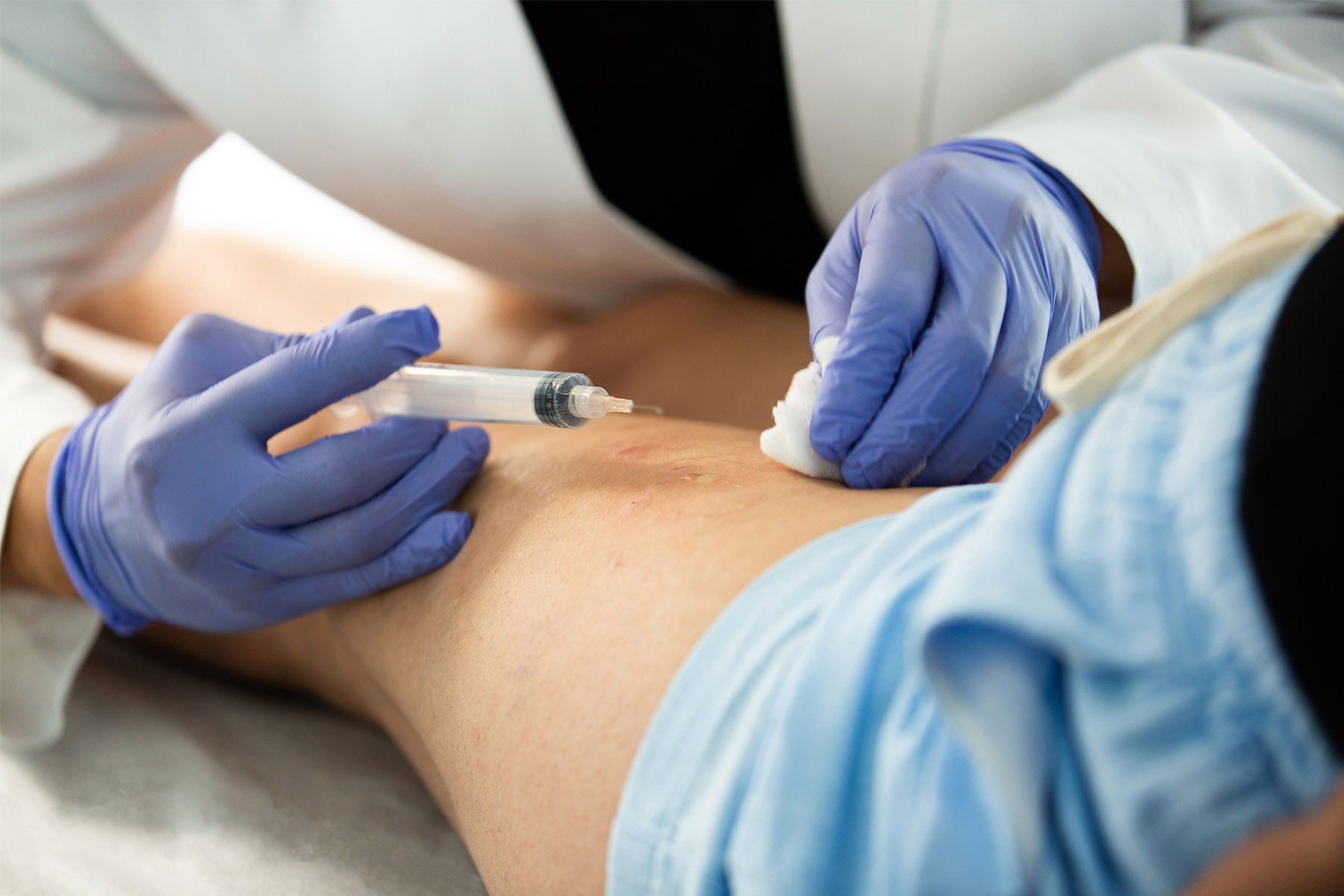 Descubra c&oacute;mo funciona el deducible de su seguro m&eacute;dico para el tratamiento de las venas. Descubra qu&eacute; est&aacute; cubierto, qu&eacute; no lo est&aacute; y cu&aacute;ndo conviene programar la atenci&oacute;n para maximizar su ahorro.