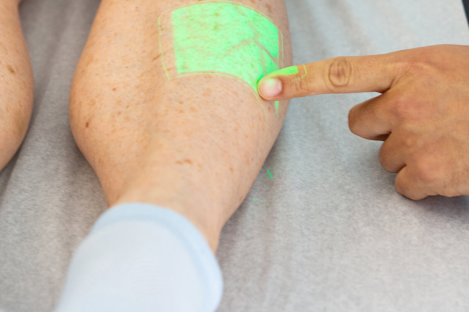 Aprende a identificar las complicaciones post-tratamiento después de procedimientos en las venas. Comprende los síntomas, recibe consejos para la recuperación y sabe cuándo buscar ayuda médica.