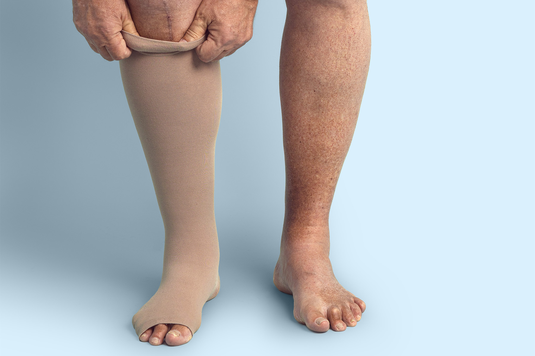 La salud venosa favorece la circulación, la energía y la movilidad. Prevenga las várices, la insuficiencia venosa crónica (IVC), la hinchazón y la pesadez en las piernas con hábitos simples de bienestar.