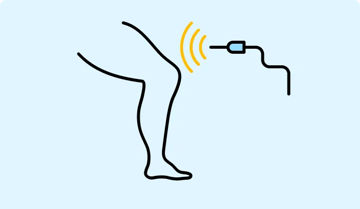 Endovenous Laser Ablation