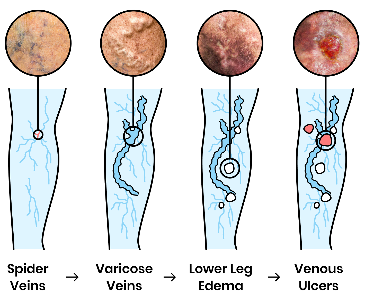 Your Future Legs Will Thank You