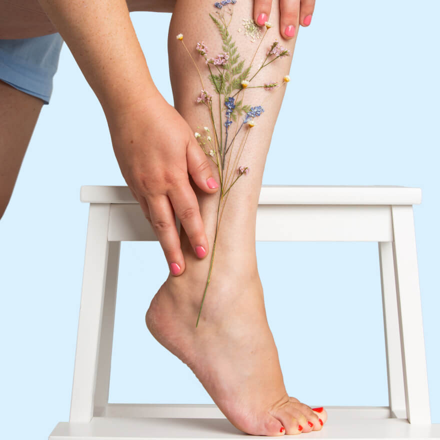 Leg Veins  Laser Skin Care